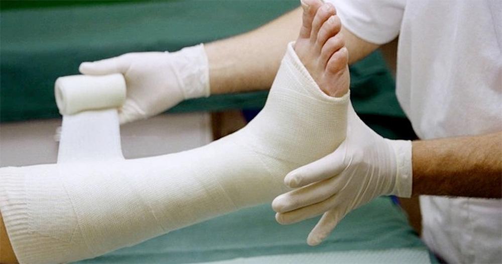 Cast rubbing on skin: What to do, pain relief tips & more